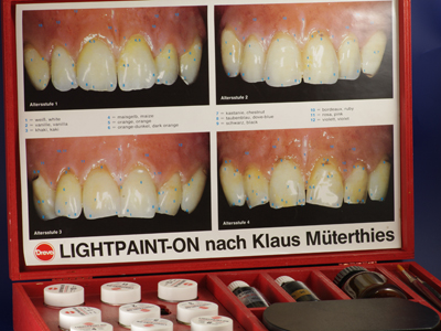 Zweitprothese oder Reiseprothese, Zahntechnik Schumacher