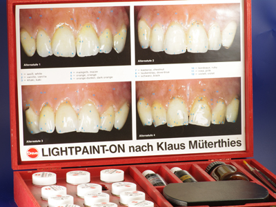 Zweitprothese oder Reiseprothese, Zahntechnik Schumacher